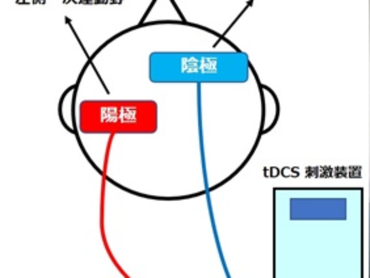 経頭蓋直流電気刺激と有酸素運動の併用で鎮痛効果が促進 畿央大学 大学ジャーナルオンライン